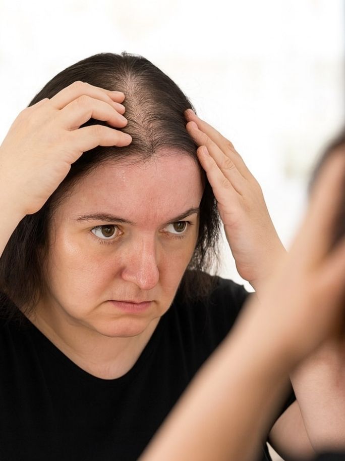 Canada Hair Alopecia Wigs and Solutions
