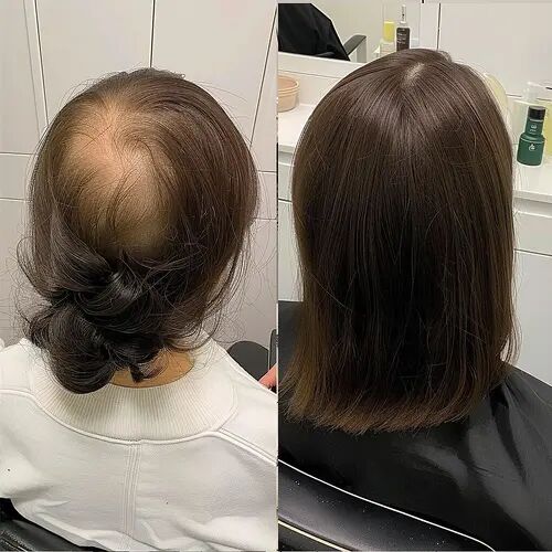 Customer wearing hair toppers