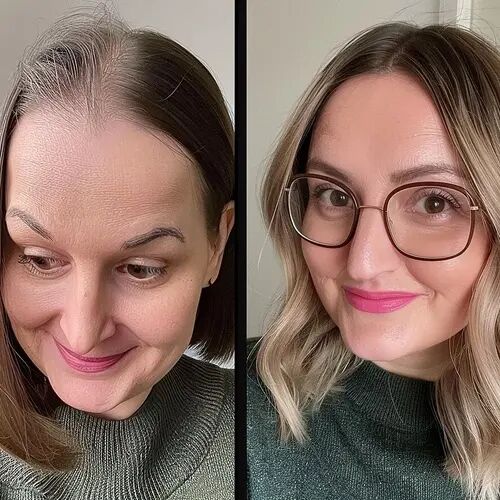 Customer wearing hair toppers